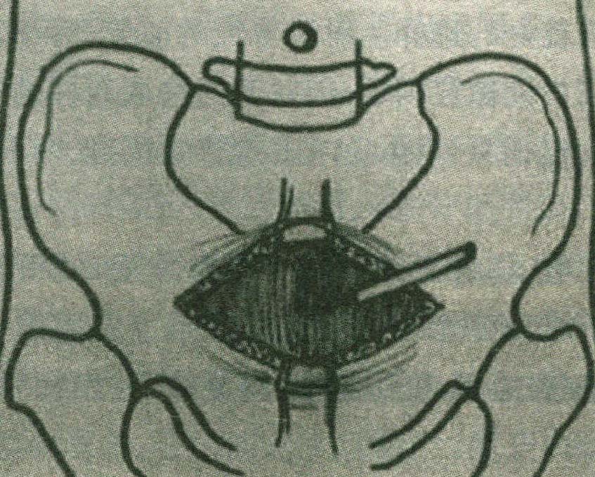 治療